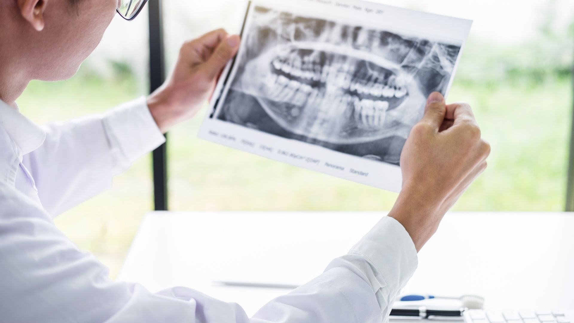 Parodontitída Aké sú príčiny vzniku, riziká a možnosti liečbyb
